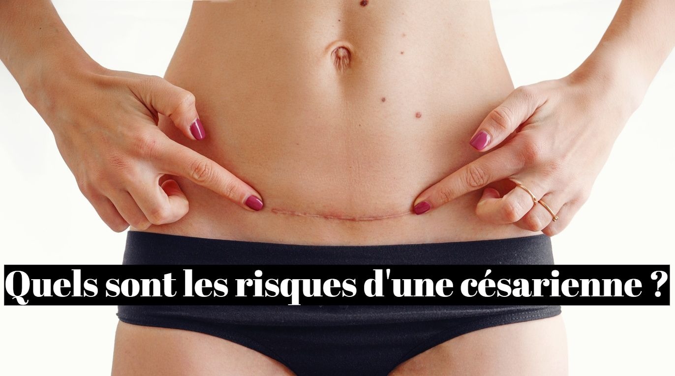 Quels sont les risques d’une césarienne ?